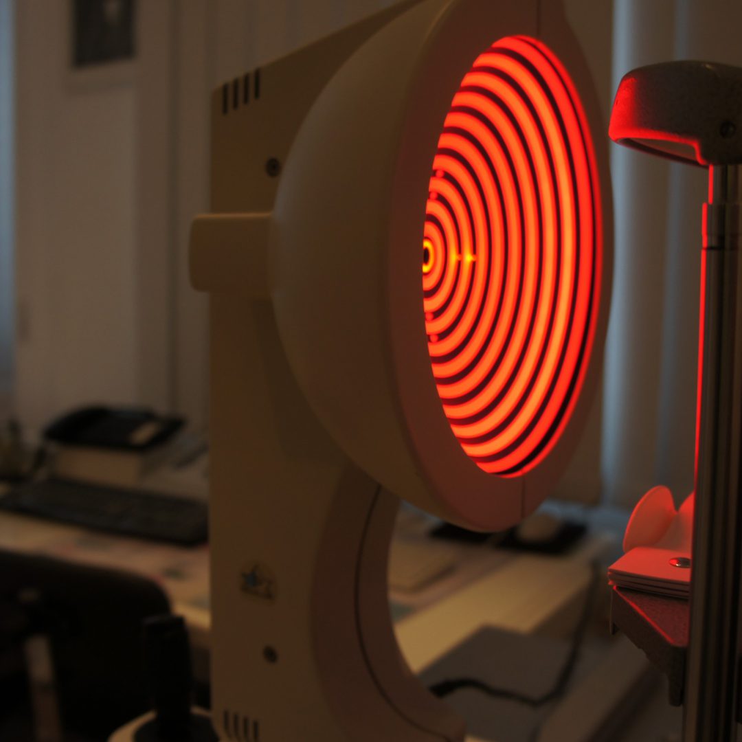 Corneale Topographie an einer modernen Messstation