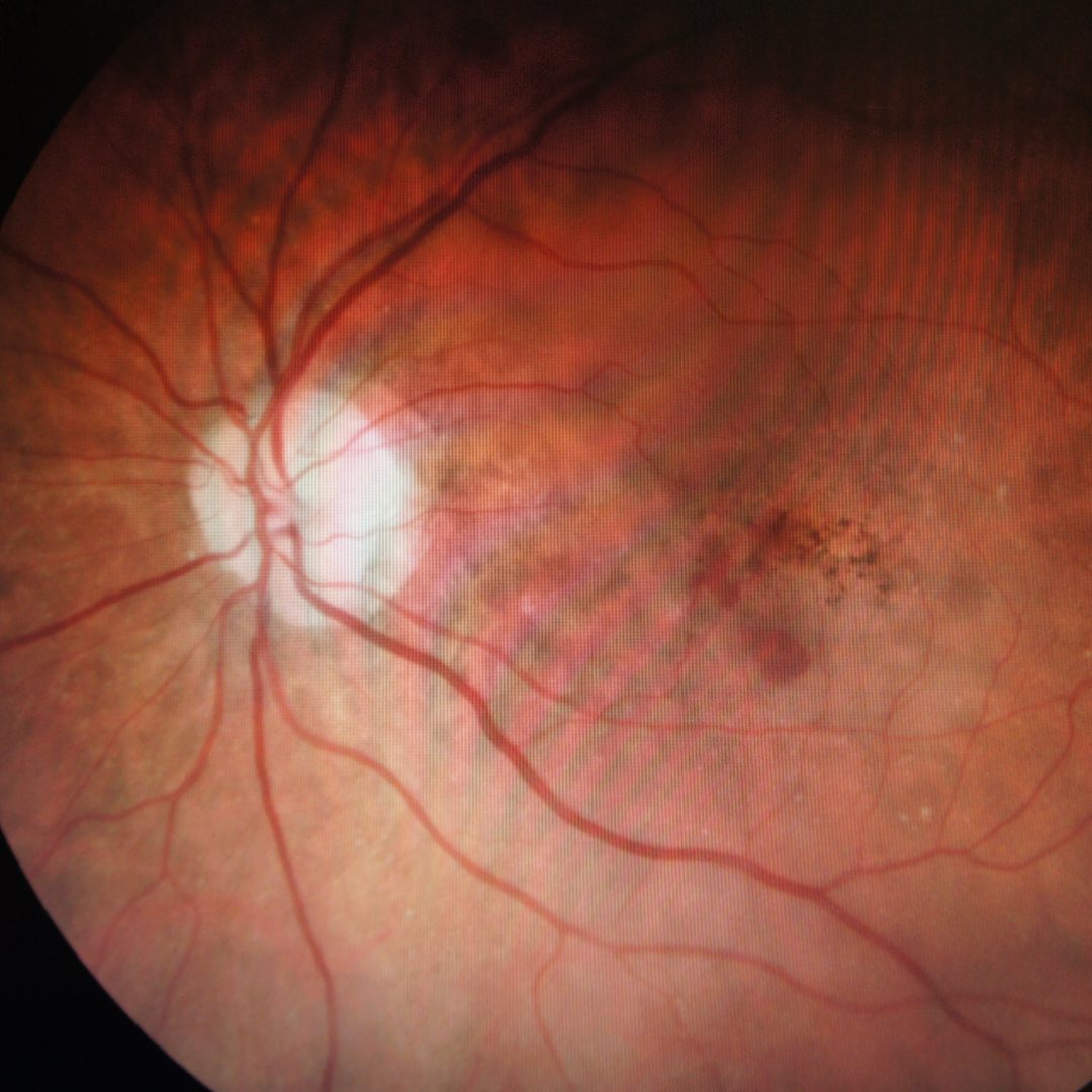 Fluoreszenzangiographie Arbeitsplatz mit Injektor