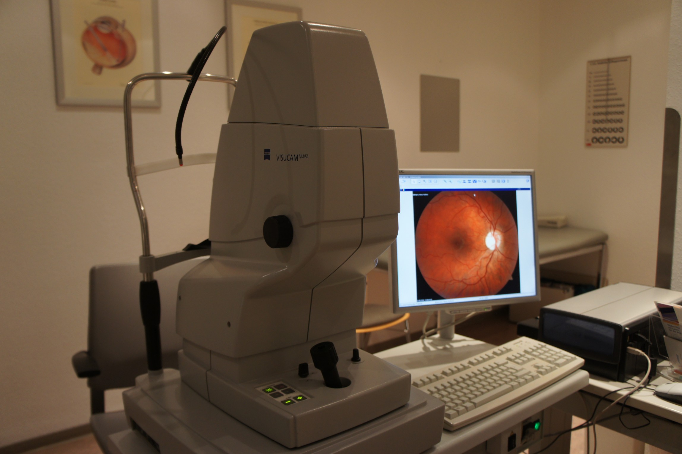 Funduskamera für Netzhautaufnahmen